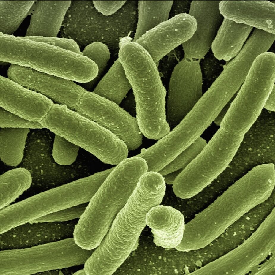 koli bacteria, escherichia coli, bacteria, disease, pathogens, microscopy, electron microscopy, electron microscope, vaccination, immune system, diseases, vaccine, escherichia, infect, infection, risk of infection, pathogen, viruses, bacteria, bacteria, bacteria, bacteria, bacteria